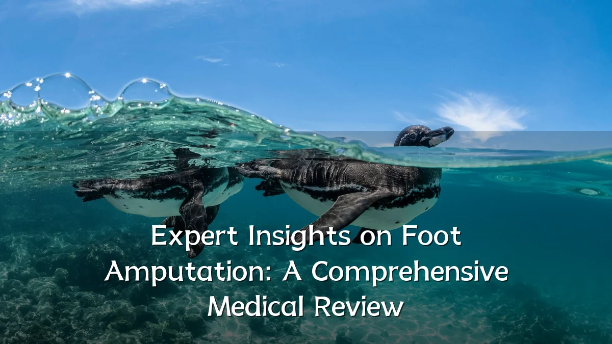 Expert Insights on Foot Amputation: A Comprehensive Medical Review