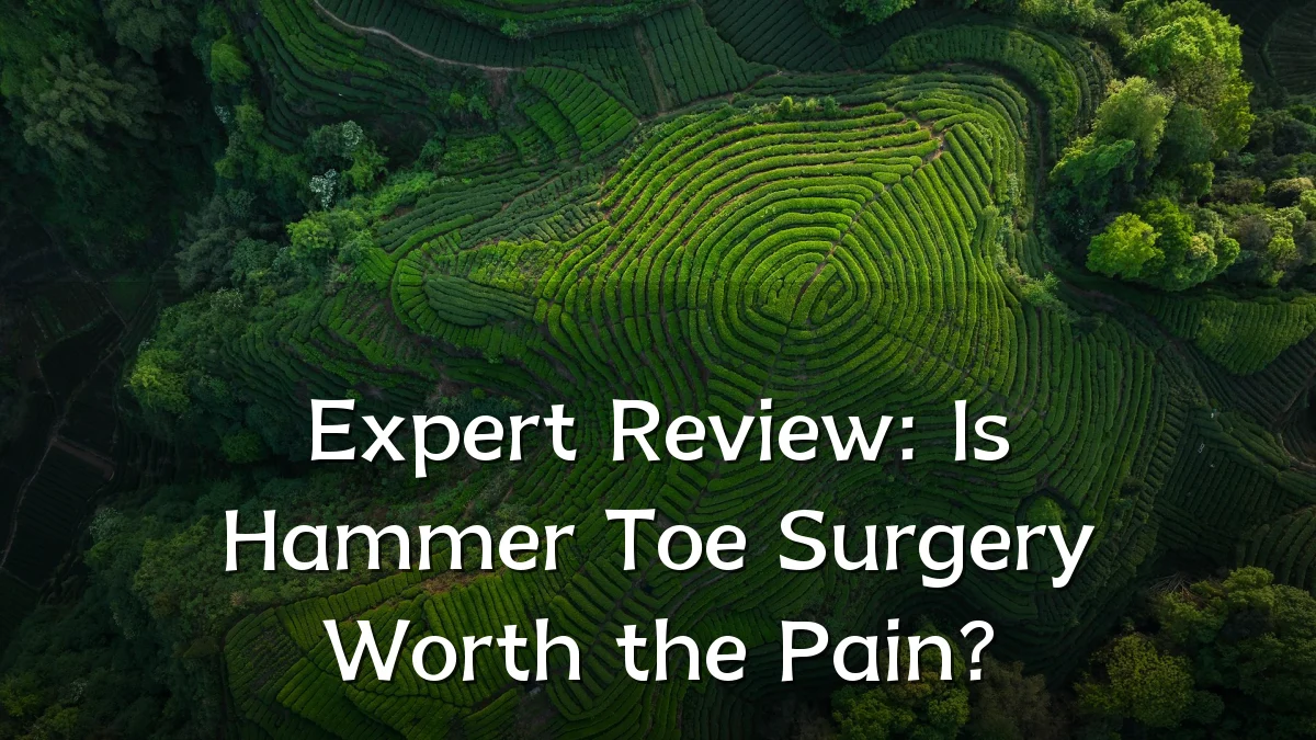 Expert Review: Is Hammer Toe Surgery Worth the Pain?
